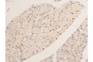 Immunohistochemistry (IHC) image for anti-Myc Proto-Oncogene protein (MYC) (pSer62) antibody (ABIN6255431)