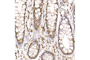 Immunohistochemistry (IHC) image for anti-Coactivator-Associated Arginine Methyltransferase 1 (CARM1) (AA 409-608) antibody (ABIN1682307)