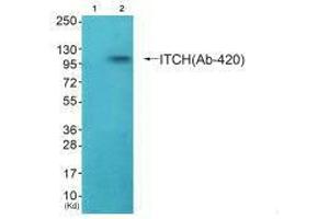 Western blot analysis of extracts from HepG2 cells (Lane 2), using ITCH (Ab-420) antiobdy.