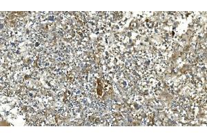 IHC analysis of Carbonic Anhydrase 13/CA13 using anti-Carbonic Anhydrase 13/CA13 antibody (ABIN7603164). (CA13 Antikörper  (N-Term))