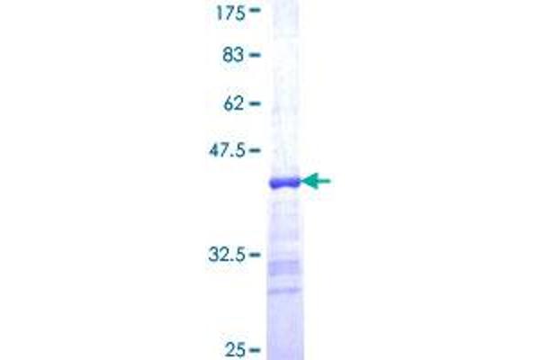 BAT1 Protein (AA 329-428) (GST tag)