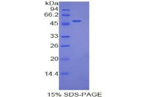 SDS-PAGE analysis of Pig Erythropoietin Protein.