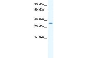 WB Suggested Anti-PDLIM1 Antibody Titration:  0. (PDLIM1 Antikörper  (Middle Region))