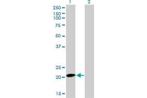 Western Blot analysis of RHOC expression in transfected 293T cell line by RHOC monoclonal antibody (M01), clone 2E12.