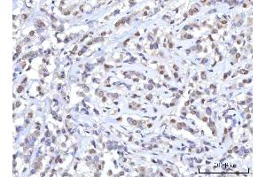 IHC analysis of RANBP2 using anti-RANBP2 antibody (ABIN7602650). (RANBP2 Antikörper  (AA 906-2744))