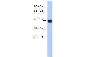 WB Suggested Anti-NEUROD4 Antibody Titration:  0. (NEUROD4 Antikörper  (Middle Region))
