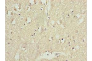 Immunohistochemistry of paraffin-embedded human brain tissue using ABIN7144078 at dilution of 1:100