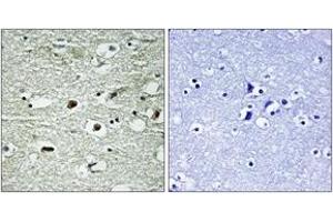 Immunohistochemistry analysis of paraffin-embedded human brain, using hnRNP C1/2 (Phospho-Ser260) Antibody. (HNRNPC Antikörper  (pSer260))