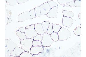 Immunohistochemistry of paraffin-embedded rat skeletal muscle using Dystrophin Rabbit mAb (ABIN7266871) at dilution of 1:100 (40x lens). (Dystrophin Antikörper)