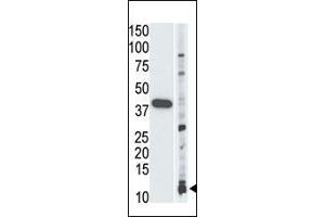Image no. 1 for anti-Small Ubiquitin Related Modifier Protein 1 (SUMO1) antibody (ABIN356806) (SUMO1 Antikörper)