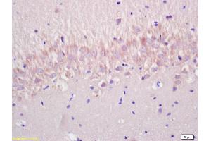 Formalin-fixed and paraffin embedded rat brain labeled with Anti-P53(wt-p53) Polyclonal Antibody, Unconjugated (ABIN677408) at 1:200 followed by conjugation to the secondary antibody and DAB staining. (p53 Antikörper  (AA 301-393))