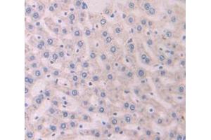 IHC-P analysis of Rat Tissue, with DAB staining. (SERPINC1 Antikörper  (AA 150-426))