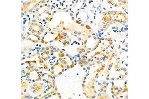 Immunohistochemistry of paraffin embedded mouse kidney using Dmac2l (ABIN7073751) at dilution of 1: 650 (400x lens) (Distal Membrane Arm Assembly Complex 2 L Homeolog (DMAC2.L) Antikörper)