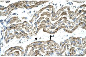 Human Muscle; HumanMuscle; C13ORF8 antibody - middle region in Human Muscle cells using Immunohistochemistry (ZNF828 Antikörper  (Middle Region))
