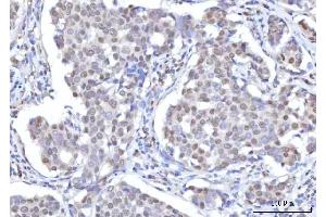 IHC analysis of RANBP2 using anti-RANBP2 antibody (ABIN7602650). (RANBP2 Antikörper  (AA 906-2744))