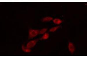 ABIN6274115 staining 293 cells by IF/ICC. (PFKFB2 Antikörper  (C-Term))
