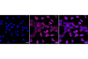 Immunocytochemical staining of C2C12 cells with RELB antibody (ABIN7800804), 1:1,000). (Rekombinanter RELB Antikörper)