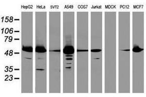 Image no. 1 for anti-Epoxide Hydrolase 1, Microsomal (Xenobiotic) (EPHX1) (AA 21-230) antibody (ABIN1491197) (EPHX1 Antikörper  (AA 21-230))