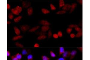 Immunofluorescence analysis of HeLa cells using CYP1B1 Polyclonal Antibody at dilution of 1:100 (40x lens). (CYP1B1 Antikörper)