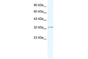 WB Suggested Anti-NUDT9 Antibody Titration:  0. (NUDT9 Antikörper  (C-Term))