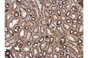 IHC-P Image ROCK2 antibody detects ROCK2 protein at cytosol on mouse kidney by immunohistochemical analysis. (ROCK2 Antikörper)