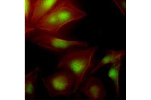 Immunofluorescence of human HeLa cells stained with Phalloidin-TRITC (Red) for Actin staining and monoclonal anti-human UBE2S antibody (1:500) with Alexa 488 (Green). (UBE2S Antikörper  (AA 1-222))