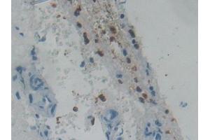 Immunohistochemistry (IHC) image for anti-Eosinophil Cationic Protein (ECP) (AA 30-154) antibody (ABIN7434023)