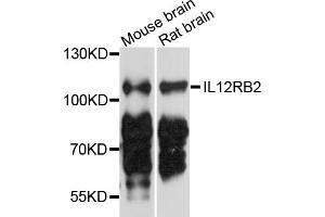 Western blot analysis of extracts of various cell lines, using IL12RB2 antibody (ABIN4904030) at 1:1000 dilution. (IL12RB2 Antikörper)