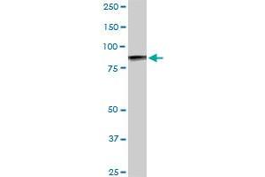 UBTF monoclonal antibody (M05), clone 2C6. (UBTF Antikörper  (AA 551-650))