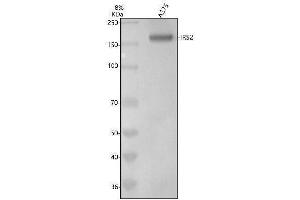 Western blot analysis of IRS2 using anti-IRS2 antibody (ABIN7605319).