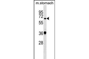 TDP1 Antibody (Center) (ABIN1538086 and ABIN2849232) western blot analysis in mouse stomach tissue lysates (35 μg/lane). (TDP1 Antikörper  (AA 212-239))