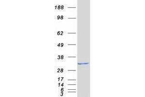 Western Blotting (WB) image for THAP Domain Containing, Apoptosis Associated Protein 1 (THAP1) (Transcript Variant 1) protein (Myc-DYKDDDDK Tag) (ABIN2733540)