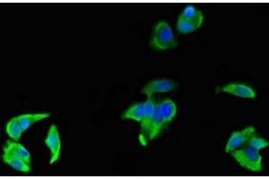 Immunofluorescent analysis of MCF-7 cells using ABIN7158547 at dilution of 1:100 and Alexa Fluor 488-congugated AffiniPure Goat Anti-Rabbit IgG(H+L)