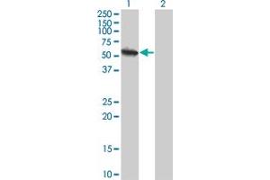 Western Blot analysis of USP3 expression in transfected 293T cell line by USP3 monoclonal antibody (M01), clone 1H2. (USP3 Antikörper  (AA 421-520))