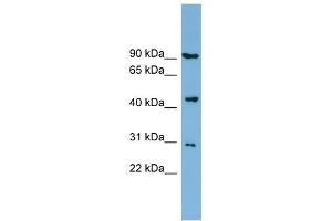 Western Blot showing TUSC4 antibody used at a concentration of 1-2 ug/ml to detect its target protein. (NPRL2 Antikörper  (Middle Region))