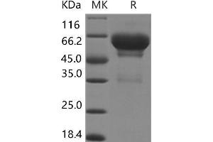 Western Blotting (WB) image for Secretogranin III (SCG3) protein (His tag) (ABIN7320015) (SCG3 Protein (His tag))