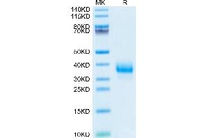 Cynomolgus Fc gamma RIIB on Tris-Bis PAGE under reduced condition. (FCGR2B Protein (AA 46-224) (His tag))