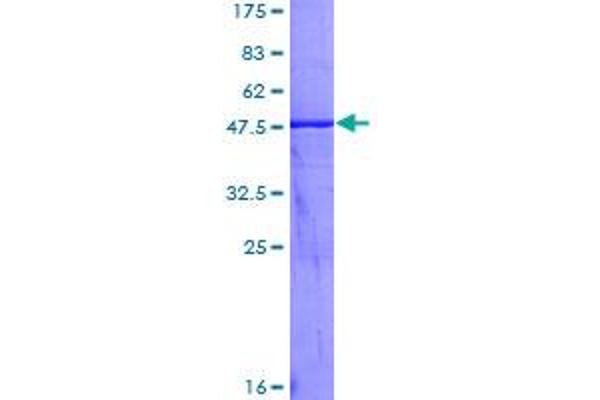 Kallikrein 2 Protein (KLK2) (AA 1-223) (GST tag)