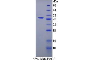 Image no. 1 for Surfactant Associated Protein A2 (SFTPA2) (AA 21-248) protein (His tag) (ABIN6238311)