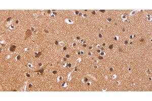 Immunohistochemistry of paraffin-embedded Human brain tissue using CSNK1D Polyclonal Antibody at dilution 1:50 (Casein Kinase 1 delta Antikörper)