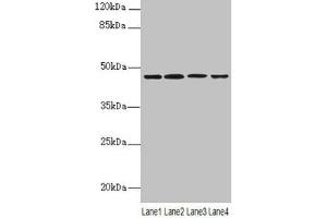 Western blot All lanes: NAPEPLD antibody at 6 μg/mL Lane 1: Mouse large intestine tissue Lane 2: Mouse kidney tissue Lane 3: Mouse stomach tissue Lane 4: MCF-7 whole cell lysate Secondary Goat polyclonal to rabbit IgG at 1/10000 dilution Predicted band size: 46 kDa Observed band size: 46 kDa
