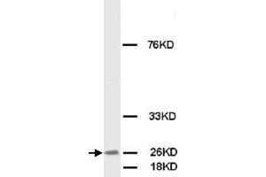 Western Blot analysis of FGF8 expression from MCF-7 cell lyate with FGF8 polyclonal antibody . (FGF8 Antikörper  (C-Term))