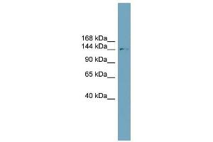 SLC4A2 antibody used at 1 ug/ml to detect target protein. (SLC4A2 Antikörper  (N-Term))