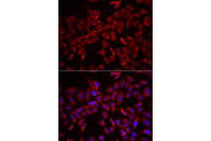 Immunofluorescence analysis of HeLa cells using CSRP3 antibody (ABIN6291316). (CSRP3 Antikörper)