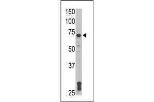 Image no. 2 for anti-TXK tyrosine Kinase (TXK) (N-Term) antibody (ABIN359999) (TXK Antikörper  (N-Term))