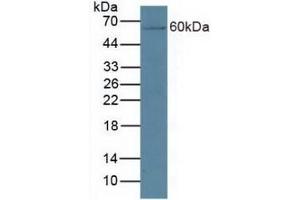 Detection of CYP27B1 in Mouse Kidney Tissue using Polyclonal Antibody to Cytochrome P450 27B1 (CYP27B1) (CYP27B1 Antikörper  (AA 251-500))