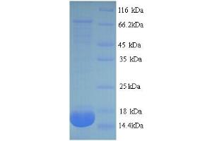 SDS-PAGE (SDS) image for Phospholipase A2, Group IIA (Platelets, Synovial Fluid) (PLA2G2A) (AA 22-146) protein (His tag) (ABIN5714042)