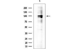 anti-DNA Repair Protein Complementing XP-B Cells (ERCC3) (N-Term) antibody