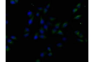 Immunofluorescence staining of Hela cells with ABIN7158896 at 1:50, counter-stained with DAPI. (MST1R Antikörper  (AA 1175-1400))