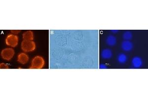 Expression of OX2R in human colon cancer cells - Immunocytochemical staining of paraformaldehyde-fixed and permeabilized human Colo-205 colon cancer cells using Anti-Orexin Receptor 2 Antibody (ABIN7043029, ABIN7044885 and ABIN7044886), (1:500), followed by goat-anti-rabbit-AlexaFluor-555 secondary antibody (red). (CD200R1 Antikörper  (C-Term, Intracellular))